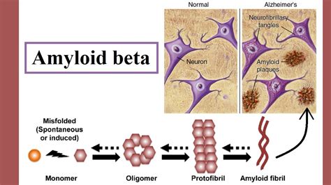 amyloid-beta|Amyloid beta .